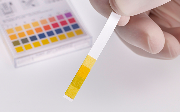 Test Paper & Test Strips